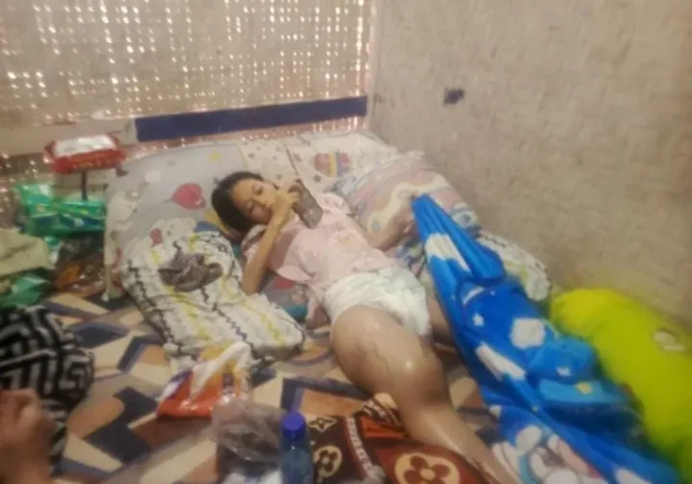 Siswi Mungil Di Garut Terbaring Lemah, Warga Soroti Kendala Administrasi Domisili Untuk Akses Bantuan