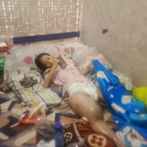 Siswi Mungil Di Garut Terbaring Lemah, Warga Soroti Kendala Administrasi Domisili Untuk Akses Bantuan