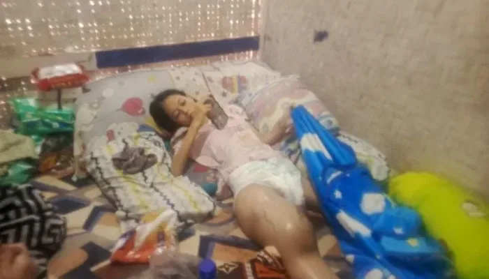 Siswi Mungil Di Garut Terbaring Lemah, Warga Soroti Kendala Administrasi Domisili Untuk Akses Bantuan