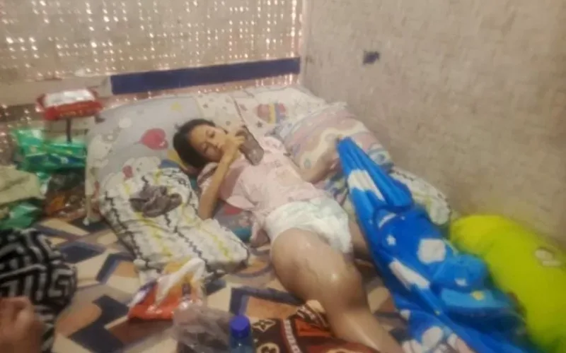 Siswi Mungil Di Garut Terbaring Lemah, Warga Soroti Kendala Administrasi Domisili Untuk Akses Bantuan