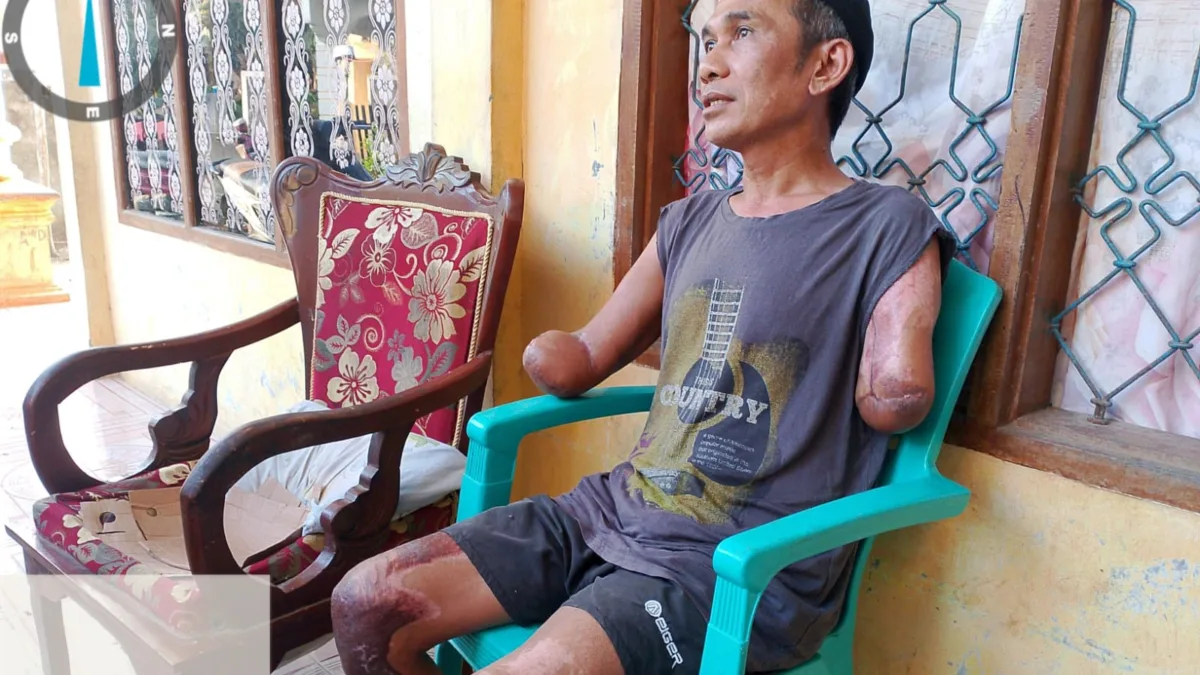 Mimpi Buruk di Sore Hari: Kisah Armin Warga Desa Batetangnga Yang Harus Kehilangan Kedua Tangannya Akibat Sengatan Listrik Tegangan Tinggi